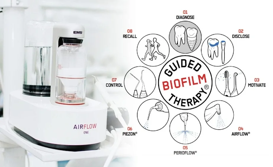 EMS Irányított Biofilm Terápia Budapest - Panoráma Dent